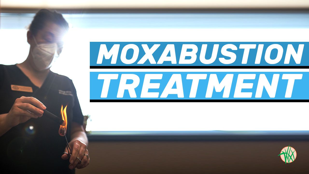 Jen performing moxibustion