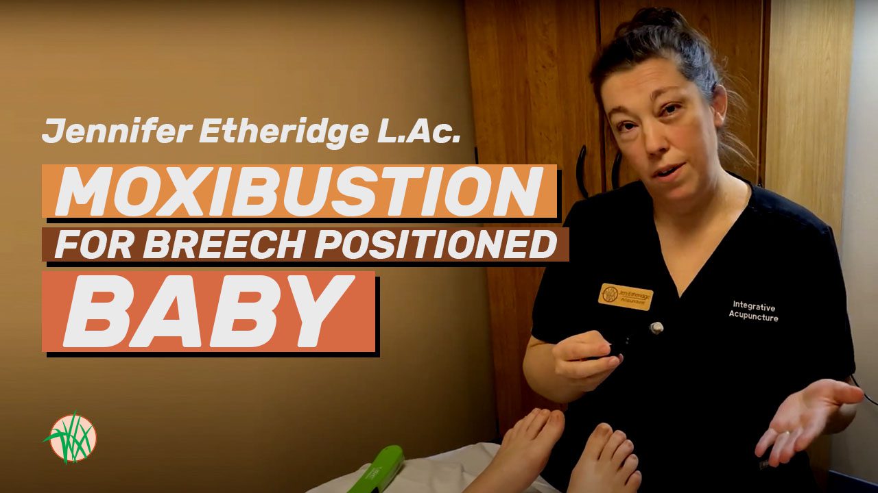 Moxibustion for a breeched baby with Jen