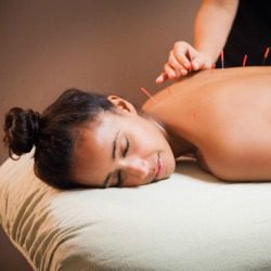 Vermont Acupuncture Reviews