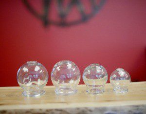 Cupping - Montpelier and Williston, Berlin, Barre & Washington County, VT