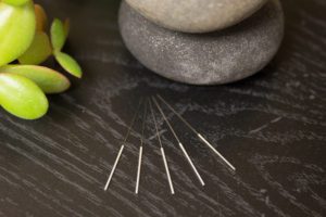 acupuncture needles