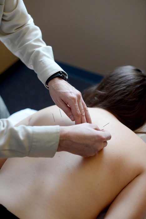 Neck Pain: Does Acupuncture Work? The Research Shows Yes