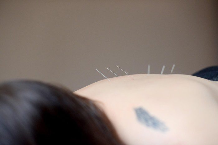 Needles in back